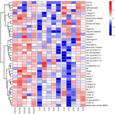 Plasma single-stranded DNA autoantibodies in the diagnosis of Hirschsprung’s disease